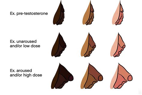 trans bottom growth meaning|Understanding bottom growth in trans men on T — My Vagina